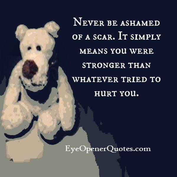 Whatever that tried to hurt you